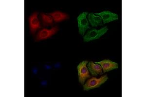ABIN6255524 and ABIN6267296 staining Hela cells(4h of LPS treatment) by IF/ICC. (HSP27 Antikörper  (pSer82))