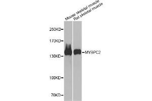 Western blot analysis of extracts of various cell lines, using MYBPC2 antibody. (MYBPC2 Antikörper)