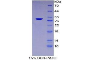 SDS-PAGE analysis of Human Lnk Protein. (SH2B3 Protein)