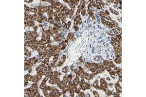 Immunohistochemical staining of human liver with GLT8D1 polyclonal antibody  shows strong granular cytoplasmic positivity in hepatocytes at 1:50-1:200 dilution. (GLT8D1 Antikörper)