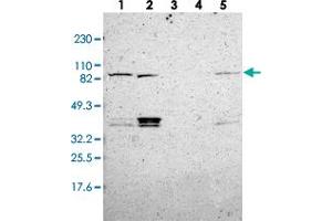 Western blot analysis of Lane 1: RT-4, Lane 2: U-251 MG, Lane 3: Human Plasma, Lane 4: Liver, Lane 5: Tonsil with MAD1L1 polyclonal antibody  at 1:250-1:500 dilution. (MAD1L1 Antikörper)