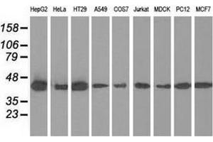 Western blot analysis of extracts (35 µg) from 9 different cell lines by using anti-IVD monoclonal antibody. (IVD Antikörper)