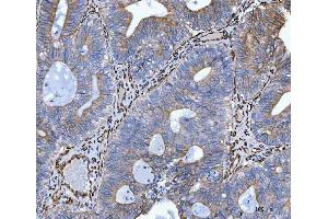 IHC analysis of Hsp47/SERPINH1 using anti-Hsp47/SERPINH1 antibody (ABIN3043331).