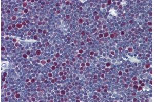 Human Thymus: Formalin-Fixed, Paraffin-Embedded (FFPE) (LIG1 Antikörper  (AA 810-920))