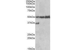 Western Blotting (WB) image for anti-Lymphocyte-Specific Protein 1 (LSP1) (C-Term) antibody (ABIN2464618) (LSP1 Antikörper  (C-Term))