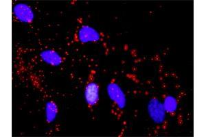 Proximity Ligation Analysis of protein-protein interactions between CDKN1A and MDM2.