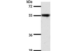 Western Blot analysis of Mouse eye tissue using SLC32A1 Polyclonal Antibody at dilution of 1:500 (SLC32A1 Antikörper)