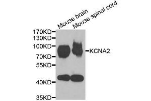 Western blot analysis of extracts of various cell lines, using KCNA2 antibody (ABIN5973718) at 1/1000 dilution. (KCNA2 Antikörper)