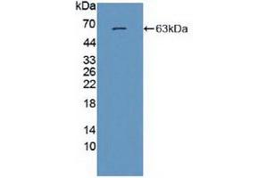 Western blot analysis of recombinant Human GRIN2A. (NMDAR2A Antikörper  (AA 31-555))