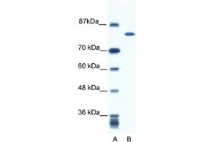 Western Blotting (WB) image for anti-Kinesin Family Member 23 (KIF23) antibody (ABIN2460845) (KIF23 Antikörper)