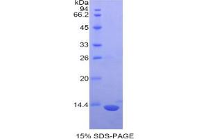 SDS-PAGE analysis of Mouse S100 Protein. (S100 Protein (S100) Protein)