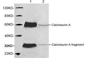 Western blot analysis of mouse brain tissue lysate using 1 µg/mL Rabbit Anti-Calcineurin A Polyclonal Antibody (ABIN398733) Lane 1: Rabbit Anti-Calcineurin A Polyclonal AntibodyLane 2: Rabbit Anti-Calcineurin A Polyclonal Antibody pre-incubated with immunizing peptideThe signal was developed with IRDyeTM 800 Conjugated Goat Anti-Rabbit IgG. (Calcineurin A Antikörper  (AA 450-500))