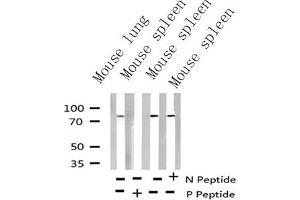 Western blot analysis of Phospho-Myb (Ser532) Antibody expression in mouse lung and mouse spleen tissues lysates.