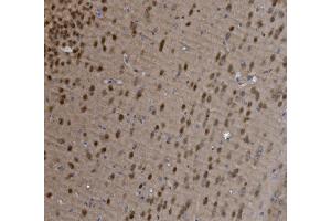 IHC analysis of MEF2C using anti-MEF2C antibody (ABIN6719606).