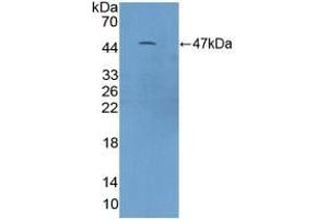 Detection of Recombinant C9, Mouse using Polyclonal Antibody to Complement Component 9 (C9)