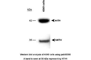 Image no. 1 for anti-Nth Endonuclease III-Like 1 (NTHL1) (full length) antibody (ABIN363407) (Nth Endonuclease III-Like 1 (NTHL1) (full length) Antikörper)