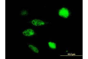 Immunofluorescence of purified MaxPab antibody to TUSC4 on HeLa cell. (NPRL2 Antikörper  (AA 1-380))