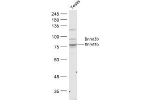 Mouse Testis lysates probed with Dnmt3b Polyclonal Antibody, Unconjugated  at 1:300 dilution and 4˚C overnight incubation. (DNMT3B Antikörper  (AA 251-350))