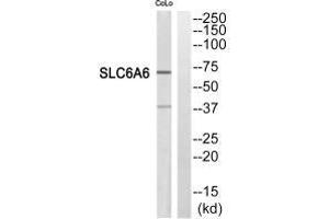 Western blot analysis of extracts from COLO205 cells, using SC6A6 antibody. (TAUT Antikörper)