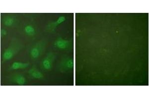 Immunofluorescence analysis of HeLa cells, using CSE1L Antibody. (Exportin 2 Antikörper  (AA 1-50))