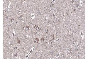 ABIN6268744 at 1/100 staining human brain tissue sections by IHC-P. (BMP6 Antikörper  (Internal Region))