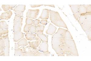 Detection of PADI2 in Human Skeletal muscle Tissue using Polyclonal Antibody to Peptidyl Arginine Deiminase Type II (PADI2) (PADI2 Antikörper)