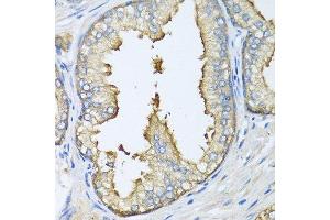 Immunohistochemistry (Paraffin-embedded Sections) (IHC (p)) image for anti-ATG5 Autophagy Related 5 (ATG5) (AA 1-275) antibody (ABIN3020674)