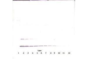 Image no. 3 for anti-Interleukin 2 (IL2) antibody (Biotin) (ABIN465290) (IL-2 Antikörper  (Biotin))