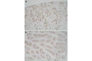 Immunohistochemistry (Formalin/PFA-fixed paraffin-embedded sections) of mouse kidney (A) and mouse epididymis (B) with Usp11 polyclonal antibody . (USP11 Antikörper)