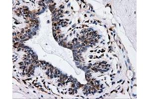 Immunohistochemical staining of paraffin-embedded breast tissue using anti-IFT57 mouse monoclonal antibody. (IFT57 Antikörper)