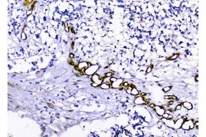 IHC analysis of Caveolin-1/CAV1 using anti-Caveolin-1/CAV1 antibody (ABIN3043803). (Caveolin-1 Antikörper  (AA 4-178))