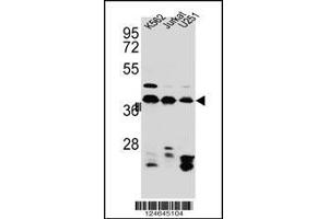 Western blot analysis in Jurkat,K562,U251 cell line lysates (35ug/lane). (HNRNPC Antikörper  (C-Term))
