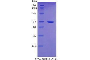 SDS-PAGE analysis of Mouse TNNT1 Protein. (TNNT1 Protein)