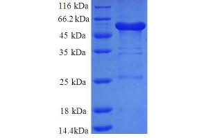 SDS-PAGE (SDS) image for Annexin A6 (ANXA6) (AA 2-245), (partial) protein (GST tag) (ABIN5712085)
