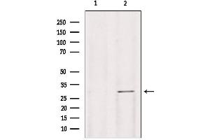 Western blot analysis of extracts from mouse lung, using Galc antibody. (GALC Antikörper  (Internal Region))