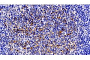 Detection of IL11Ra in Human Lymph node Tissue using Polyclonal Antibody to Interleukin 11 Receptor Alpha (IL11Ra) (IL11RA Antikörper  (AA 59-220))