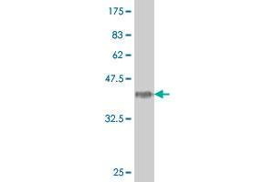 Western Blot detection against Immunogen (38. (HOXA5 Antikörper  (AA 91-200))