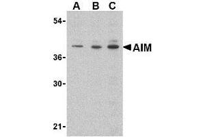Western blot analysis of AIM in Raji lysate with AP30034PU-N AIM antibody at (A) 0. (CD5L Antikörper  (C-Term))