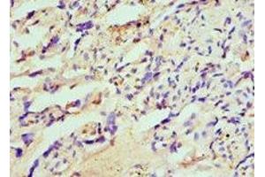 Immunohistochemistry of paraffin-embedded human placenta tissue using ABIN7155937 at dilution of 1:100 (HIP1 Antikörper  (AA 410-690))