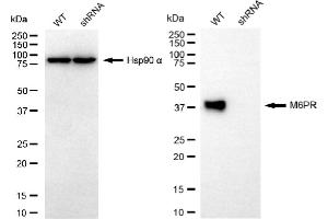 Western blotting analysis using M6PR antibody (ABIN7799331).