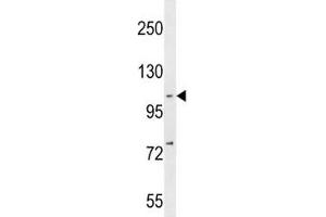 Western Blotting (WB) image for anti-Nuclear Factor of kappa Light Polypeptide Gene Enhancer in B-Cells 1 (NFKB1) (AA 911-937) antibody (ABIN3032041)