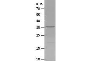Western Blotting (WB) image for Killer Cell Lectin-Like Receptor Subfamily G, Member 1 (KLRG1) (AA 60-195) protein (His-IF2DI Tag) (ABIN7123688) (KLRG1 Protein (AA 60-195) (His-IF2DI Tag))