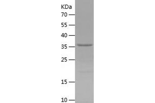 KLRG1 Protein (AA 60-195) (His-IF2DI Tag)
