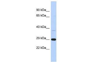 C1ORF74 antibody used at 1 ug/ml to detect target protein. (C1ORF74 Antikörper  (N-Term))