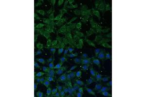 Immunofluorescence analysis of L929 cells using NF-kB p65/RelA antibody (ABIN3016234, ABIN3016235, ABIN3016236 and ABIN6219643) at dilution of 1:100. (NF-kB p65 Antikörper  (AA 50-180))