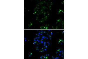 Immunofluorescence analysis of A549 cell using BOC antibody. (BOC Antikörper)