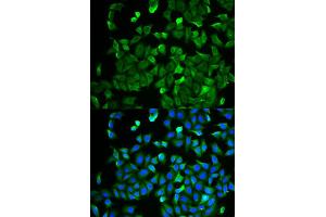 Immunofluorescence analysis of HeLa cell using NF2 antibody. (Merlin Antikörper)