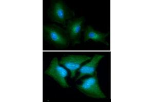 ICC/IF analysis of GOT1 in A549 cells line, stained with DAPI (Blue) for nucleus staining and monoclonal anti-human GOT1 antibody (1:100) with goat anti-mouse IgG-Alexa fluor 488 conjugate (Green). (GOT1 Antikörper  (AA 1-413))