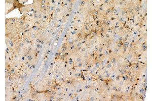 ABIN6263390 and ABIN6274052 at 1/100 staining Mouse brain tissue by IHC-P. (MSI1 Antikörper  (C-Term))