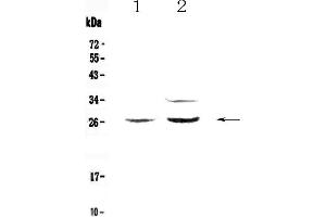 Western blot analysis of Betacellulin using anti-Betacellulin antibody .